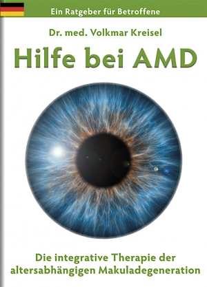 Hilfe bei AMD